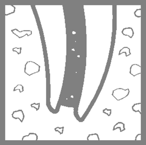 Root canal preparation